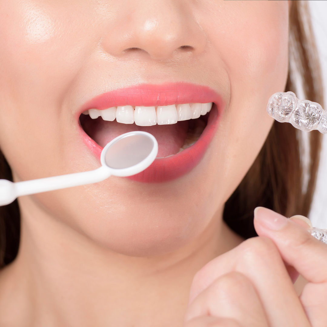 Orthodontie fonctionnelle